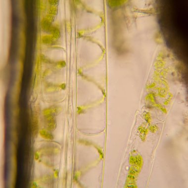 Taze su birikintisi su planktonları ve yosun, mikroskop. Spirogyra