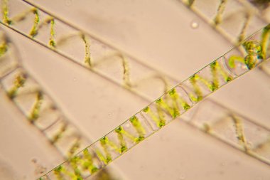 Fresh pond water plankton and algae at the microscope. Spirogyra clipart