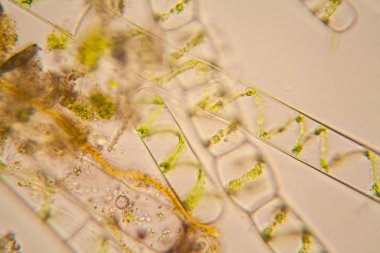 Taze su birikintisi su planktonları ve yosun, mikroskop. Spirogyra