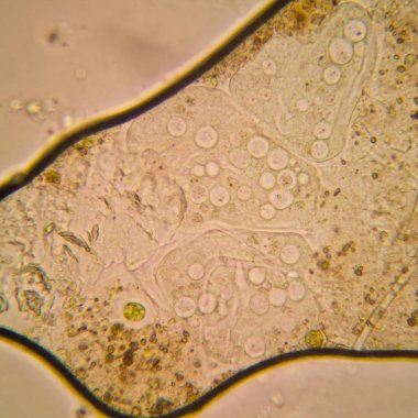 Taze su birikintisi su planktonları ve yosun, mikroskop. Vorticella convallaria