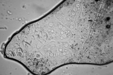 Taze su birikintisi su planktonları ve yosun, mikroskop. Vorticella convallaria