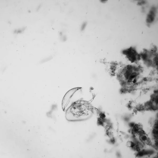 Fresh Pond Water Plankton Algae Microscope Ostracod Crustacean — Stock Photo, Image