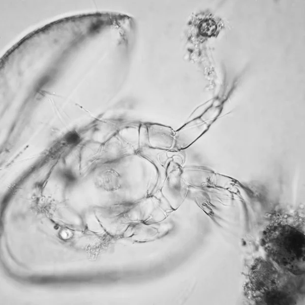Plancton Agua Dulce Algas Microscopio Ostracod Crustáceo — Foto de Stock