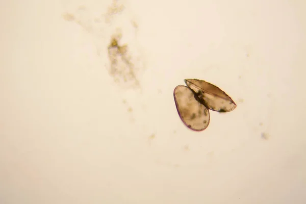 Čerstvé Rybníka Vodní Plankton Řasy Mikroskopu Korýši Lasturnatky — Stock fotografie