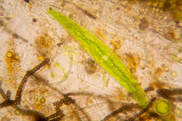 Süßwasser Plankton Und Algen Mikroskop Nostoc Commune Und Grüne Algen — Stockfoto
