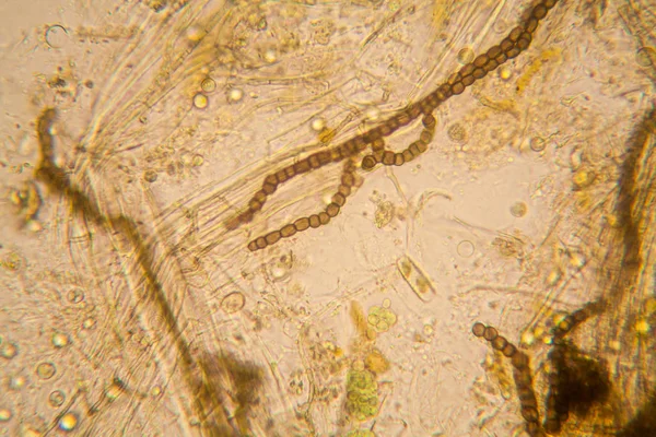 Taze su birikintisi su planktonları ve yosun, mikroskop. Nostoc komün