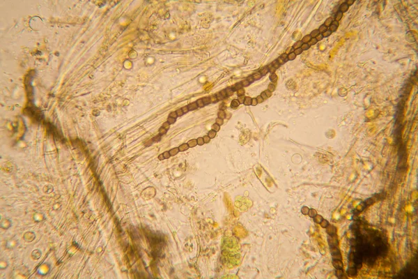 신선한 플랑크톤 그리고 현미경에서 Nostoc — 스톡 사진