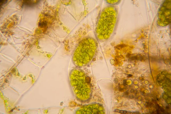 Φρέσκια Λίμνη Νερού Πλαγκτόν Και Φύκια Στο Μικροσκόπιο Spirogyra — Φωτογραφία Αρχείου