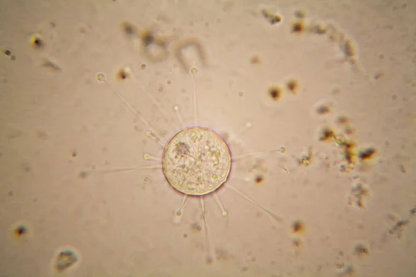 Čerstvé Rybníka Vodní Plankton Řasy Mikroskopu — Stock fotografie