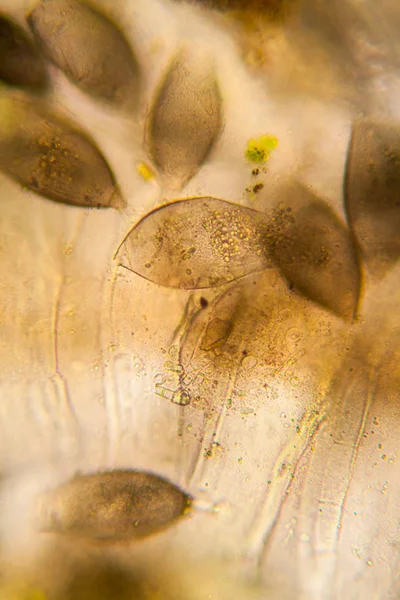 Fresh Pond Water Plankton Algae Microscope — Stock Photo, Image