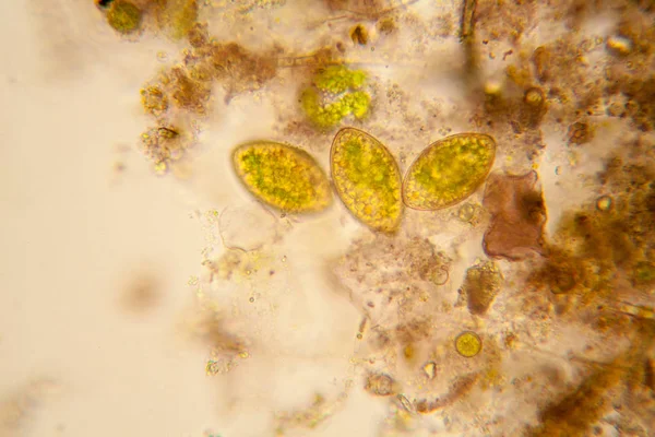 淡水池塘水浮游生物和藻类在显微镜下 叶绿体 — 图库照片