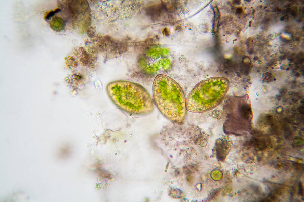 Fresh pond water plankton and algae at the microscope. Chloroplasts
