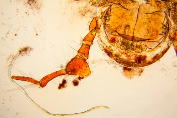 Plancton Agua Dulce Algas Microscopio Ácaro Estanque — Foto de Stock