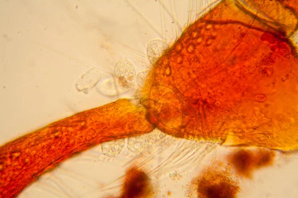 Süßwasser Plankton Und Algen Mikroskop Teichmilbe Körperteile — Stockfoto