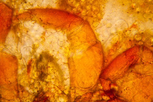 Plancton Agua Dulce Algas Microscopio Ácaro Del Estanque Partes Del — Foto de Stock