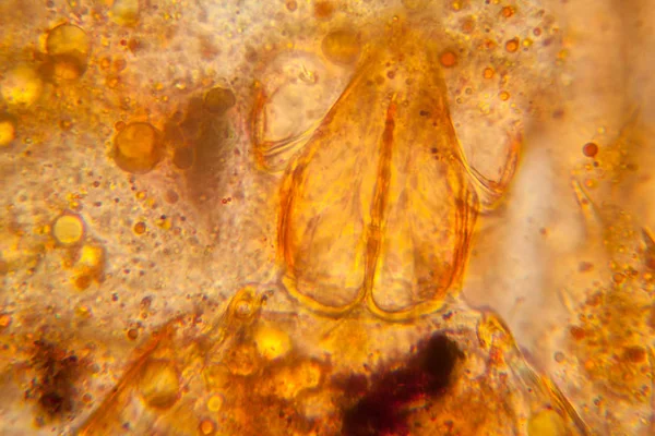 Fresh Pond Water Plankton Algae Microscope Pond Mite Body Parts — Stock Photo, Image