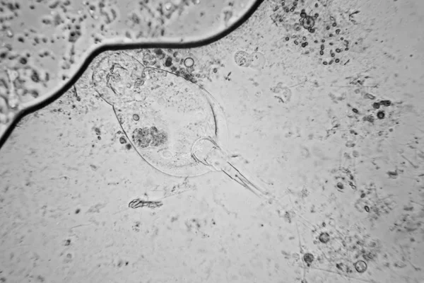 淡水池塘水浮游生物和海藻在显微镜下 — 图库照片