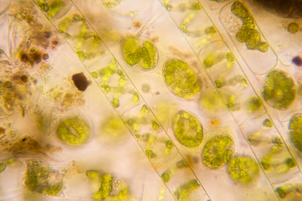 Fresh pond water plankton and algae at the microscope. Spirogyra