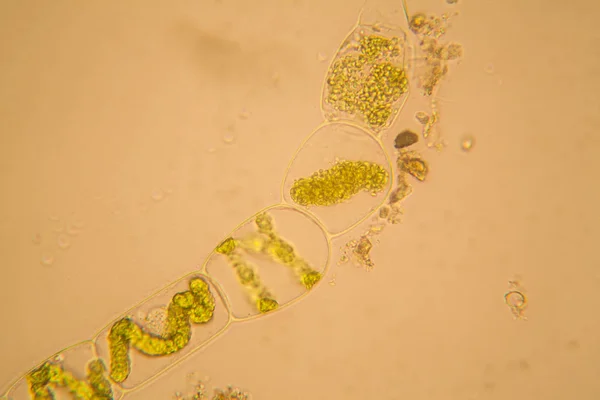 신선한 플랑크톤 그리고 현미경에서 Spirogyra — 스톡 사진