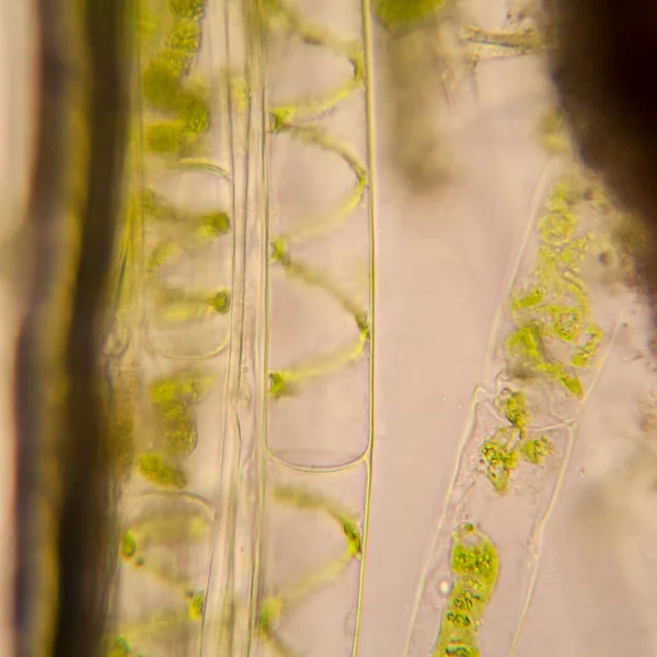 淡水池塘水浮游生物和藻类在显微镜下 Spirogyra — 图库照片