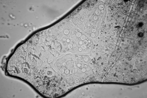 Taze Birikintisi Planktonları Yosun Mikroskop Vorticella Convallaria — Stok fotoğraf