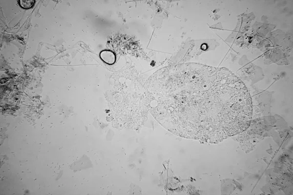 Φρέσκια Λίμνη Νερού Πλαγκτόν Και Φύκια Στο Μικροσκόπιο Πρωτόζωα Convallaria — Φωτογραφία Αρχείου