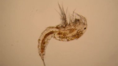 Taze su birikintisi su planktonları ve yosun, mikroskop. Copepod