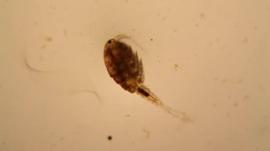 Taze su birikintisi su planktonları ve yosun, mikroskop. Copepod ve Yuvarlak solucanlar