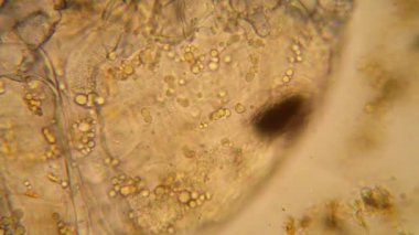 Taze su birikintisi su planktonları ve yosun, mikroskop. Copepod ayrıntıları