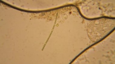 Taze su birikintisi su planktonları ve yosun, mikroskop. Vorticella convallaria ve Nostoc komün