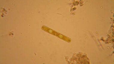 Taze su birikintisi su planktonları ve yosun, mikroskop. Diyatomlarla