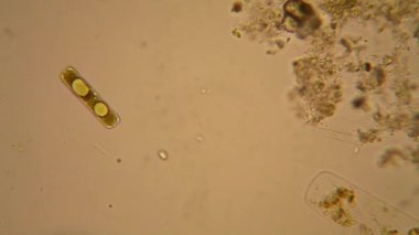 Taze su birikintisi su planktonları ve yosun, mikroskop. Diyatomlarla