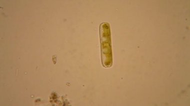 Taze su birikintisi su planktonları ve yosun, mikroskop. Diyatomlarla