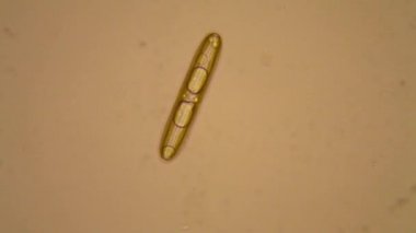 Taze su birikintisi su planktonları ve yosun, mikroskop. Diyatomlarla
