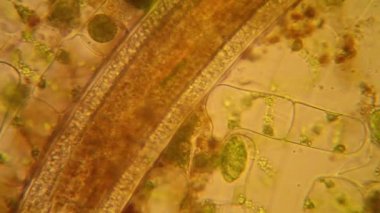 Taze su birikintisi su planktonları ve yosun, mikroskop. Yuvarlak solucanlar