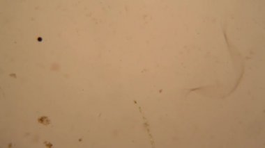 Taze su birikintisi su planktonları ve yosun, mikroskop. Yuvarlak solucanlar