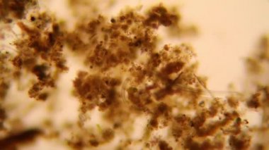 Taze su birikintisi su planktonları ve yosun, mikroskop. Yuvarlak solucanlar