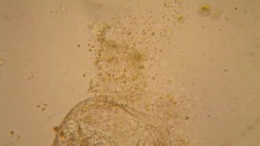 Taze su birikintisi su planktonları ve yosun, mikroskop