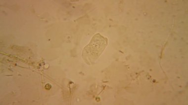 Taze su birikintisi su planktonları ve yosun, mikroskop