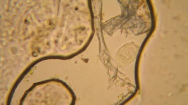 Taze su birikintisi su planktonları ve yosun, mikroskop