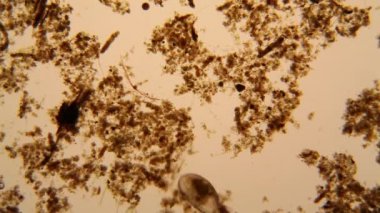 Taze su birikintisi su planktonları ve yosun, mikroskop. Ostracod eklem bacaklılar