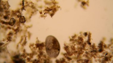 Taze su birikintisi su planktonları ve yosun, mikroskop. Ostracod eklem bacaklılar