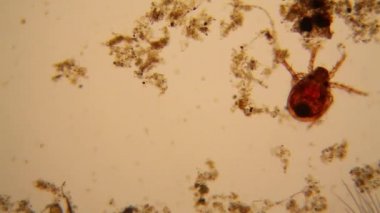 Taze su birikintisi su planktonları ve yosun, mikroskop. Gölet akar