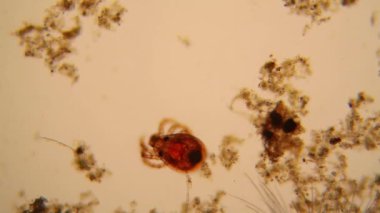 Taze su birikintisi su planktonları ve yosun, mikroskop. Gölet akar