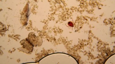 Taze su birikintisi su planktonları ve yosun, mikroskop. Gölet akar, ölü copepod ve ölü Ostracod eklem bacaklılar