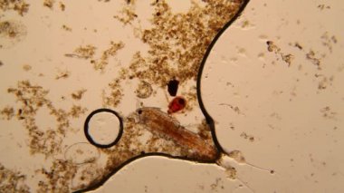 Taze su birikintisi su planktonları ve yosun, mikroskop. Gölet akar ve ölü copepod