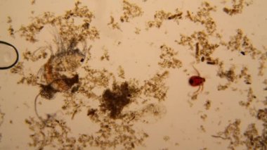 Taze su birikintisi su planktonları ve yosun, mikroskop. Gölet akar ve ölü copepod