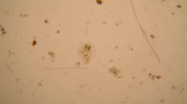 Taze su birikintisi su planktonları ve yosun, mikroskop. Wrotek