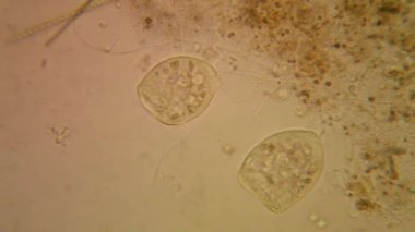 Taze su birikintisi su planktonları ve yosun, mikroskop. Vorticella convallaria