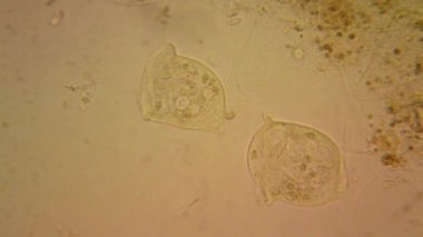 Taze su birikintisi su planktonları ve yosun, mikroskop. Vorticella convallaria